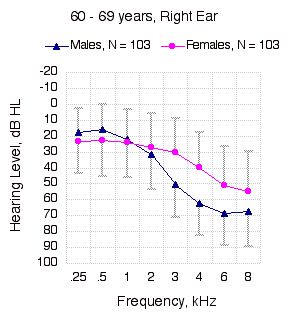 Pure Tone Thresholds, 60 - 69 years