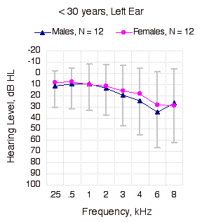 Pure Tone Thresholds, < 30 years