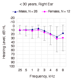 Pure Tone Thresholds, < 30 years